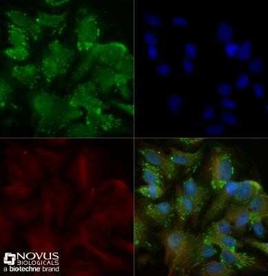 Immunocytochemistry/ Immunofluorescence: TRAILR2/TNFRSF10B Antibody - Azide Free [NB100-55744]