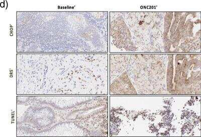 Immunohistochemistry: TRAILR2/TNFRSF10B Antibody [NB100-56618]