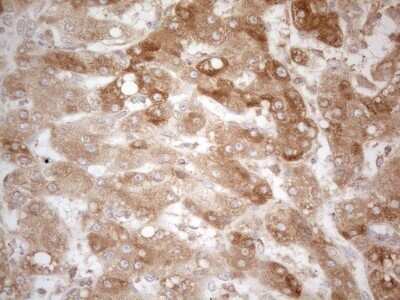 Immunohistochemistry: TRAILR2/TNFRSF10B Antibody (OTI2A5) - Azide and BSA Free [NBP2-74578]