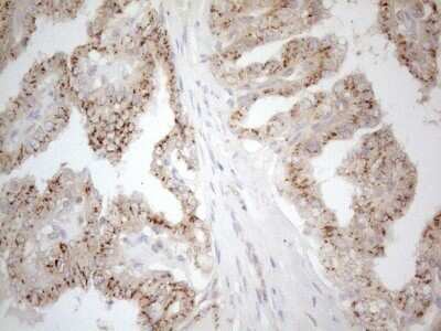 Immunohistochemistry: TRAILR2/TNFRSF10B Antibody (OTI2A5) - Azide and BSA Free [NBP2-74578]