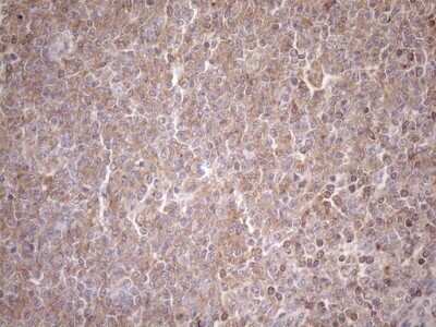 Immunohistochemistry: TRAILR2/TNFRSF10B Antibody (OTI2A5) - Azide and BSA Free [NBP2-74578]