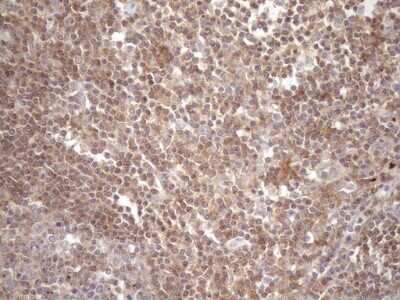 Immunohistochemistry: TRAILR2/TNFRSF10B Antibody (OTI2A5) - Azide and BSA Free [NBP2-74578]