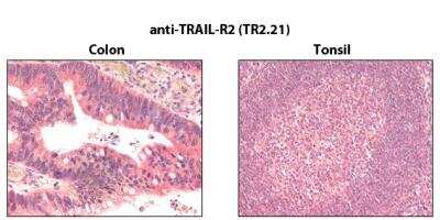 Immunohistochemistry-Paraffin: TRAILR2/TNFRSF10B Antibody (TR2.21) - BSA Free [NBP2-80070]
