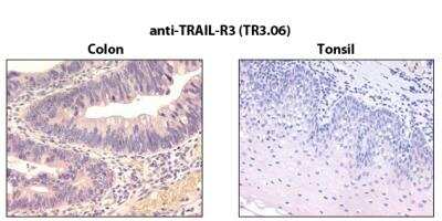 Immunohistochemistry-Paraffin: TRAILR3/TNFRSF10C Antibody (TR3.06) - BSA Free [NBP2-80071]