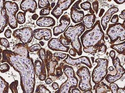Immunohistochemistry-Paraffin: TRAILR4/TNFRSF10D/DcR2 Antibody (009) [NBP2-89478]