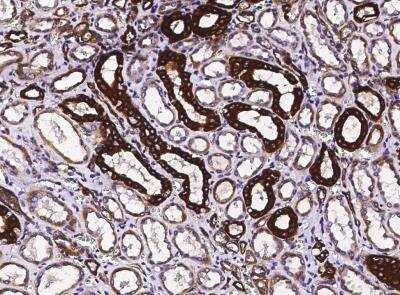 Immunohistochemistry-Paraffin: TRAILR4/TNFRSF10D/DcR2 Antibody (009) [NBP2-89478]