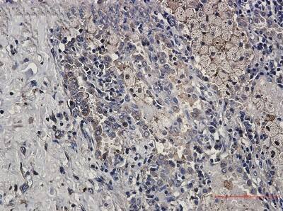 Immunohistochemistry-Paraffin: TRAILR4/TNFRSF10D/DcR2 Antibody (S01-1F0) [NBP3-20037]