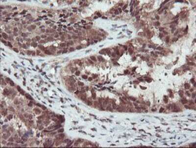 Immunohistochemistry-Paraffin: TRAIP Antibody (OTI2D4) [NBP2-03822]
