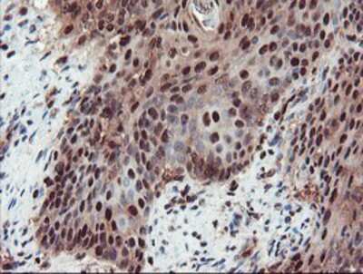 Immunohistochemistry-Paraffin: TRAIP Antibody (OTI2D4) [NBP2-03822]