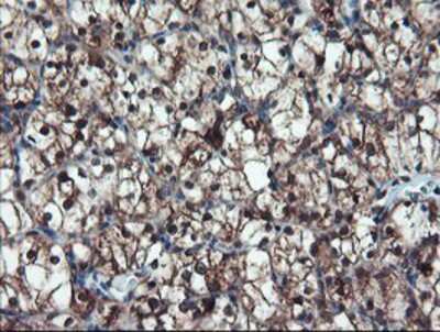 Immunohistochemistry-Paraffin: TRAIP Antibody (OTI2D4) [NBP2-03822]