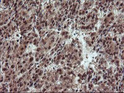 Immunohistochemistry-Paraffin: TRAIP Antibody (OTI2D4) [NBP2-03822]