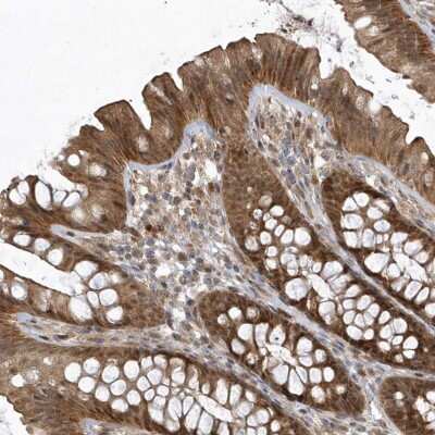 Immunohistochemistry: TRAIP Antibody [NBP2-48655]