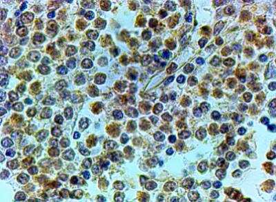 Immunohistochemistry-Paraffin: TRAIP Antibody [NB100-1230]