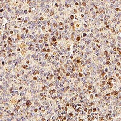 Immunohistochemistry-Paraffin: TRAIP Antibody [NB100-56180]