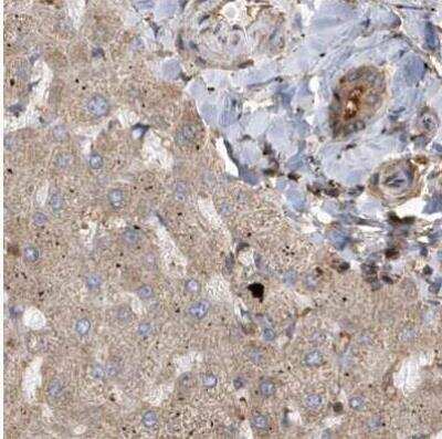 Immunohistochemistry-Paraffin: TRAIP Antibody [NBP1-87125]