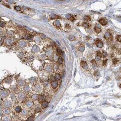 Immunohistochemistry-Paraffin: TRAIP Antibody [NBP1-87125]