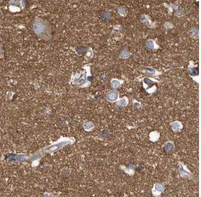 Immunohistochemistry-Paraffin: TRAIP Antibody [NBP1-87125]