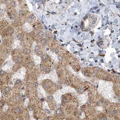 Immunohistochemistry-Paraffin: TRAIP Antibody [NBP2-48655]