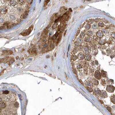 Immunohistochemistry-Paraffin: TRAIP Antibody [NBP2-48655]