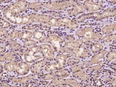 Immunohistochemistry-Paraffin: TRAIP Antibody [NBP2-97328]