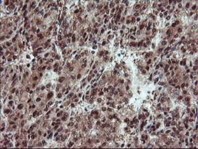 Immunohistochemistry: TRAIP Antibody (OTI2D4) - Azide and BSA Free [NBP2-74580]