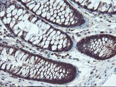 Immunohistochemistry: TRAIP Antibody (OTI2D4) - Azide and BSA Free [NBP2-74580]