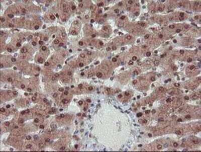 Immunohistochemistry: TRAIP Antibody (OTI2D4) - Azide and BSA Free [NBP2-74580]