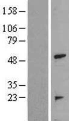 Western Blot: TRAIP Overexpression Lysate [NBL1-17250]