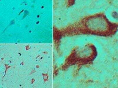 Immunohistochemistry-Paraffin: TRAM/TICAM2 Antibody [NBP2-24638]