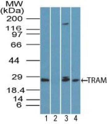 Western Blot: TRAM/TICAM2 Antibody [NBP2-24638]