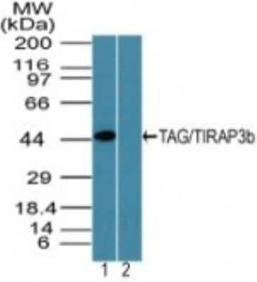 Western Blot: TRAM/TICAM2 Antibody [NBP2-24686]