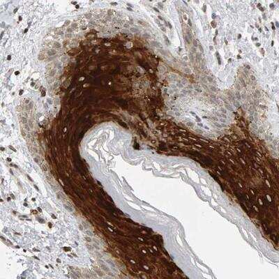 Immunohistochemistry-Paraffin: TRAM1 Antibody [NBP1-80669]