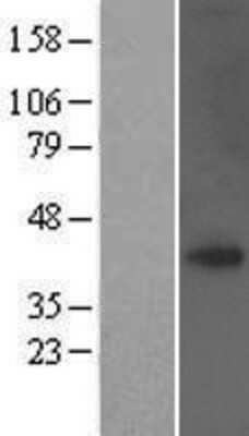 Western Blot: TRAM1 Overexpression Lysate [NBP2-07358]