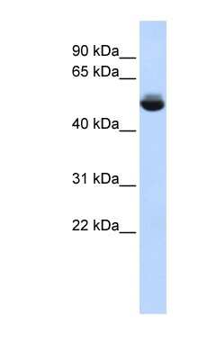 Western Blot: TRAM1L1 Antibody [NBP1-60111]