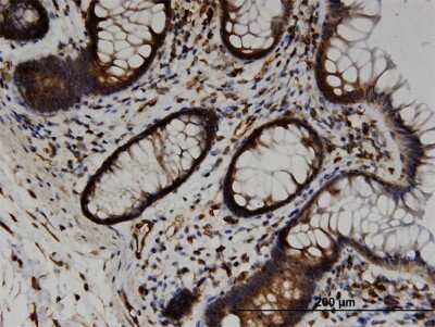 Immunohistochemistry-Paraffin: TRAM2 Antibody (3G6) [H00009697-M03]