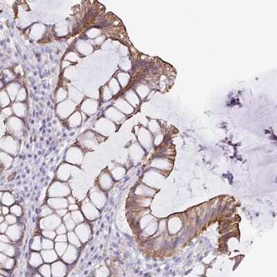 Immunohistochemistry: TRAM2 Antibody [NBP2-38836]