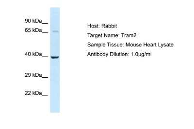 Western Blot: TRAM2 Antibody [NBP2-88453]