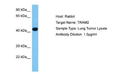 Western Blot: TRAM2 Antibody [NBP2-88454]