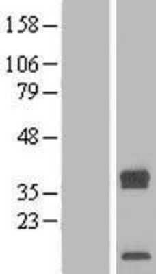 Western Blot: TRAM2 Overexpression Lysate [NBL1-17254]