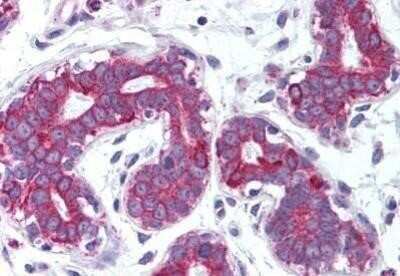 Immunohistochemistry-Paraffin: TRANCE/TNFSF11/RANK L Antibody - BSA Free [NB100-80849]