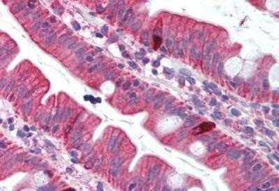 Immunohistochemistry-Paraffin: TRANCE/TNFSF11/RANK L Antibody - BSA Free [NB100-80849]