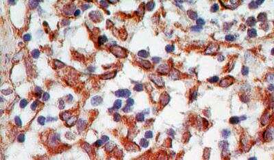 Immunohistochemistry-Paraffin: TRANCE/TNFSF11/RANK L Antibody (12A668) - Azide and BSA Free [NB100-56593]