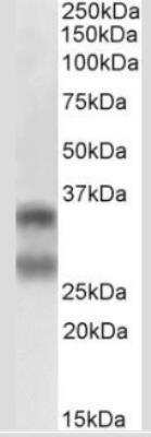 Western Blot: TRANCE/TNFSF11/RANK L Antibody (12A668)Azide and BSA Free [NB100-56593]