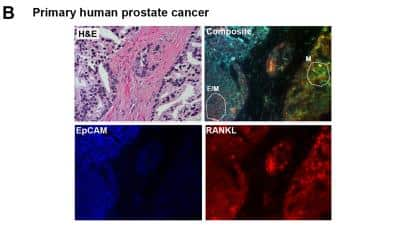 Immunohistochemistry: TRANCE/TNFSF11/RANK L Antibody (12A668) - BSA Free [NB100-56512]