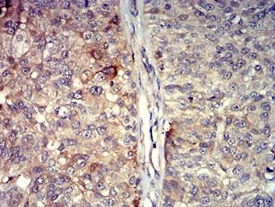 Immunohistochemistry-Paraffin: TRANCE/TNFSF11/RANK L Antibody (8A7B9) - BSA Free [NBP2-61813]