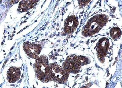 Immunohistochemistry-Paraffin: TRANCE/TNFSF11/RANK L Antibody [NBP1-31140]