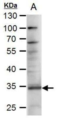 Western Blot: TRANCE/TNFSF11/RANK L Antibody [NBP1-31140]