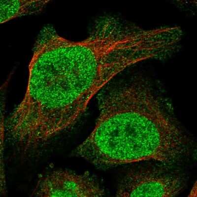 Immunocytochemistry/ Immunofluorescence: TRANK1 Antibody [NBP1-93641]