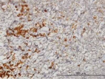 Immunohistochemistry-Paraffin: TRAP alpha Antibody (1A12) [H00006745-M01]