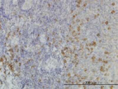 Immunohistochemistry-Paraffin: TRAP alpha Antibody (1C11) [H00006745-M02]